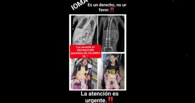Basta de jugar con la salud de mi hija”: fuerte reclamo contra IOMA por cirugías suspendidas